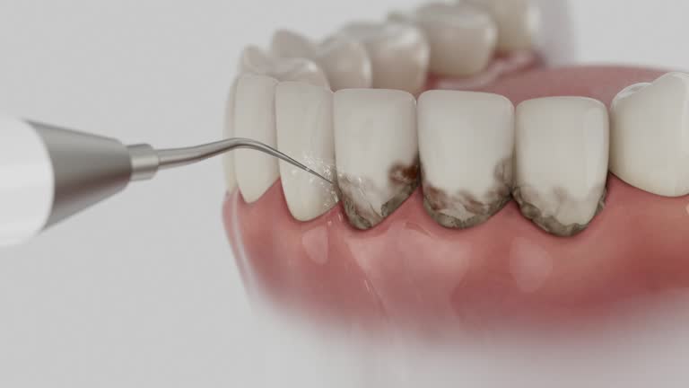 Reliable Teeth Cleaning And Checkup contractor in Preble County County, OH by Dentist Open Now